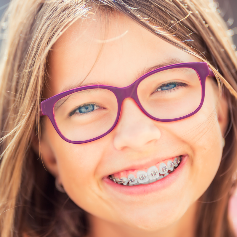 A importância da Ortodontia infantil: o melhor momento para começar