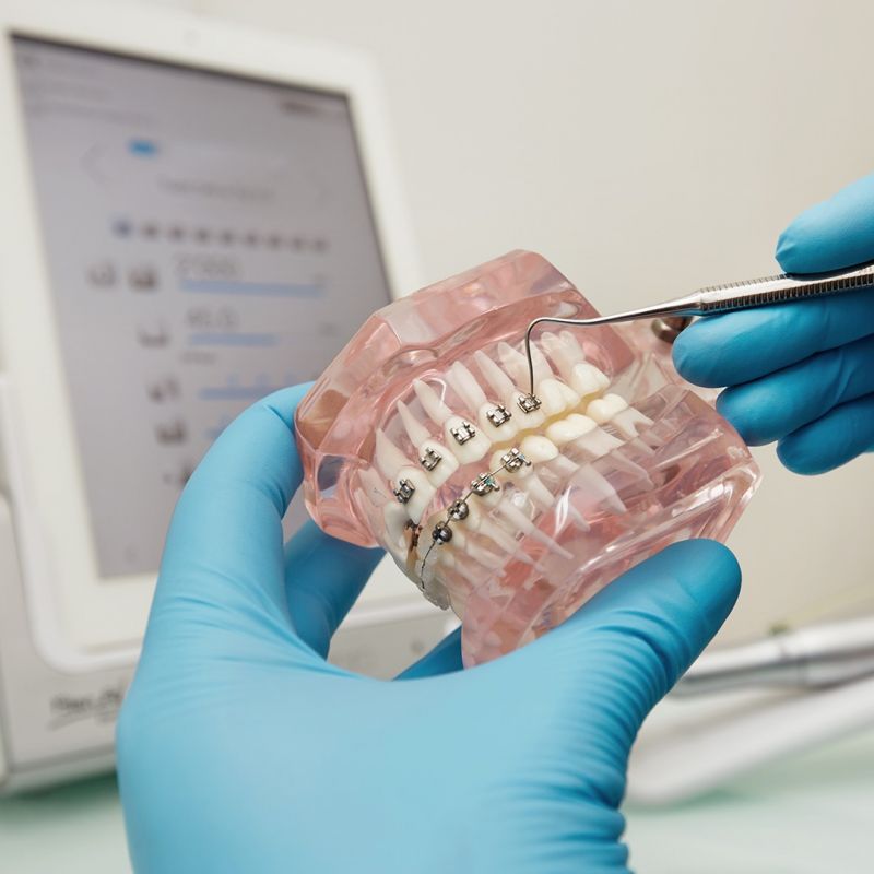 Por que os mini-implantes são essenciais na Ortodontia moderna?